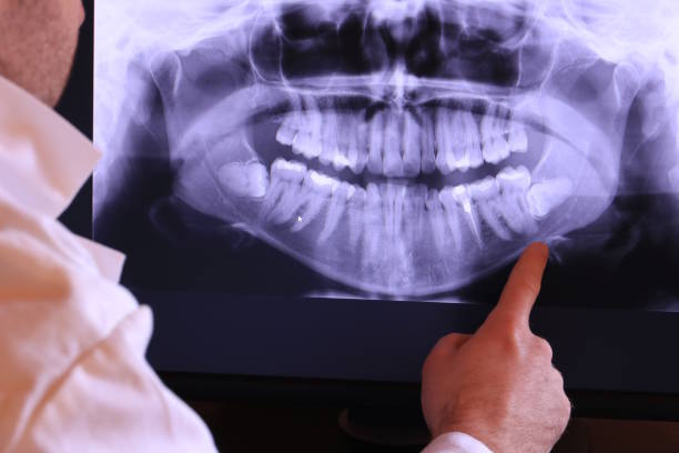 Best Orthodontic Emergency Dentist in University Of Lifornia Santa Barbara, CA