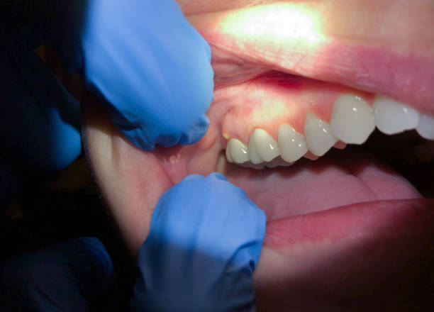 Best Emergency Cosmetic Dentistry in University Of Lifornia Santa Barbara, CA