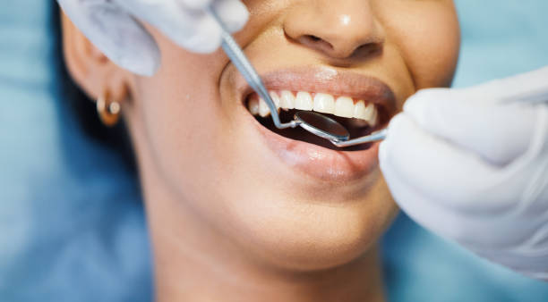 Best Pediatric Emergency Dentist in University Of Lifornia Santa Barbara, CA