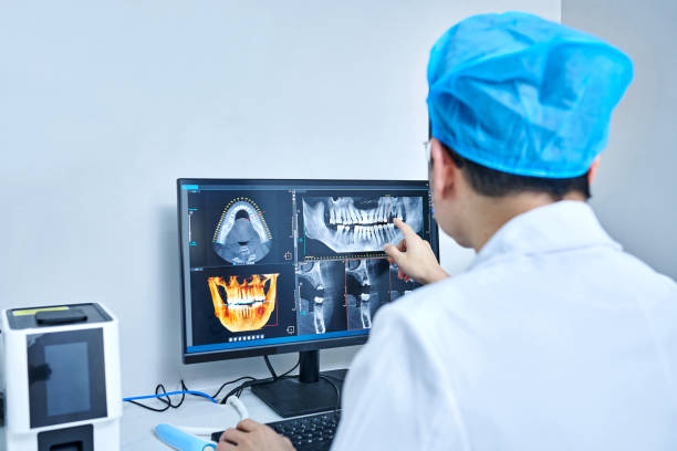 Best Emergency Dentist for Lost Fillings or Crowns in University Of Lifornia Santa Barbara, CA